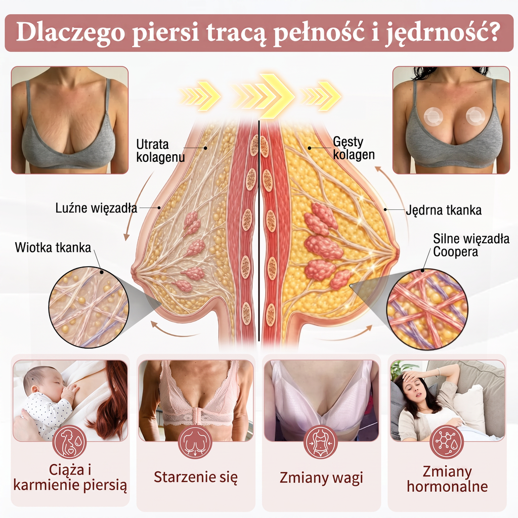 🌟 HISKIN® Mikroigłowe plastry na piersi wspierające efekt pełniejszego wyglądu, liftingu i ujędrnienia