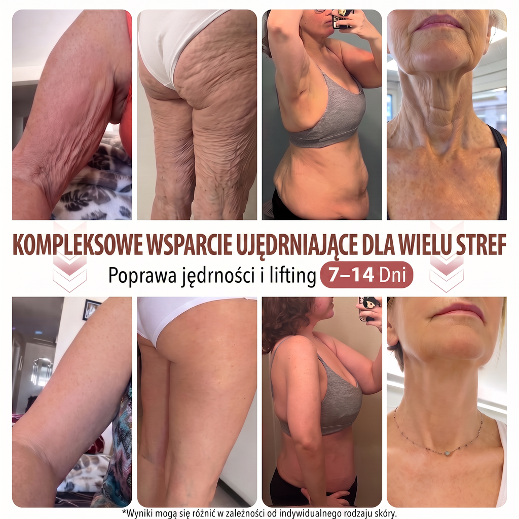 🌟 HISKIN® Mikroigłowe plastry na piersi wspierające efekt pełniejszego wyglądu, liftingu i ujędrnienia